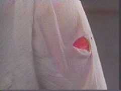 A wound by any other name....